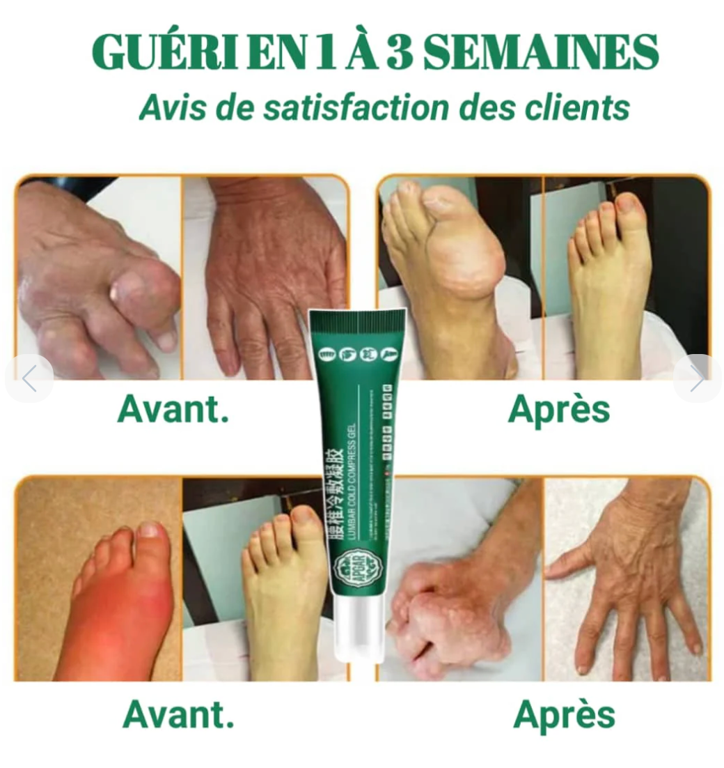 Gel Réparateur Articulaire – Soulagement Rapide et Profond des Douleurs
