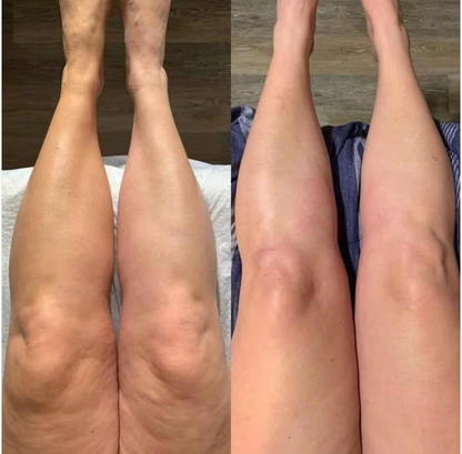 Drainage Lymphatique Liquide – Visage Affiné, Jambes Légères, Ventre Plat