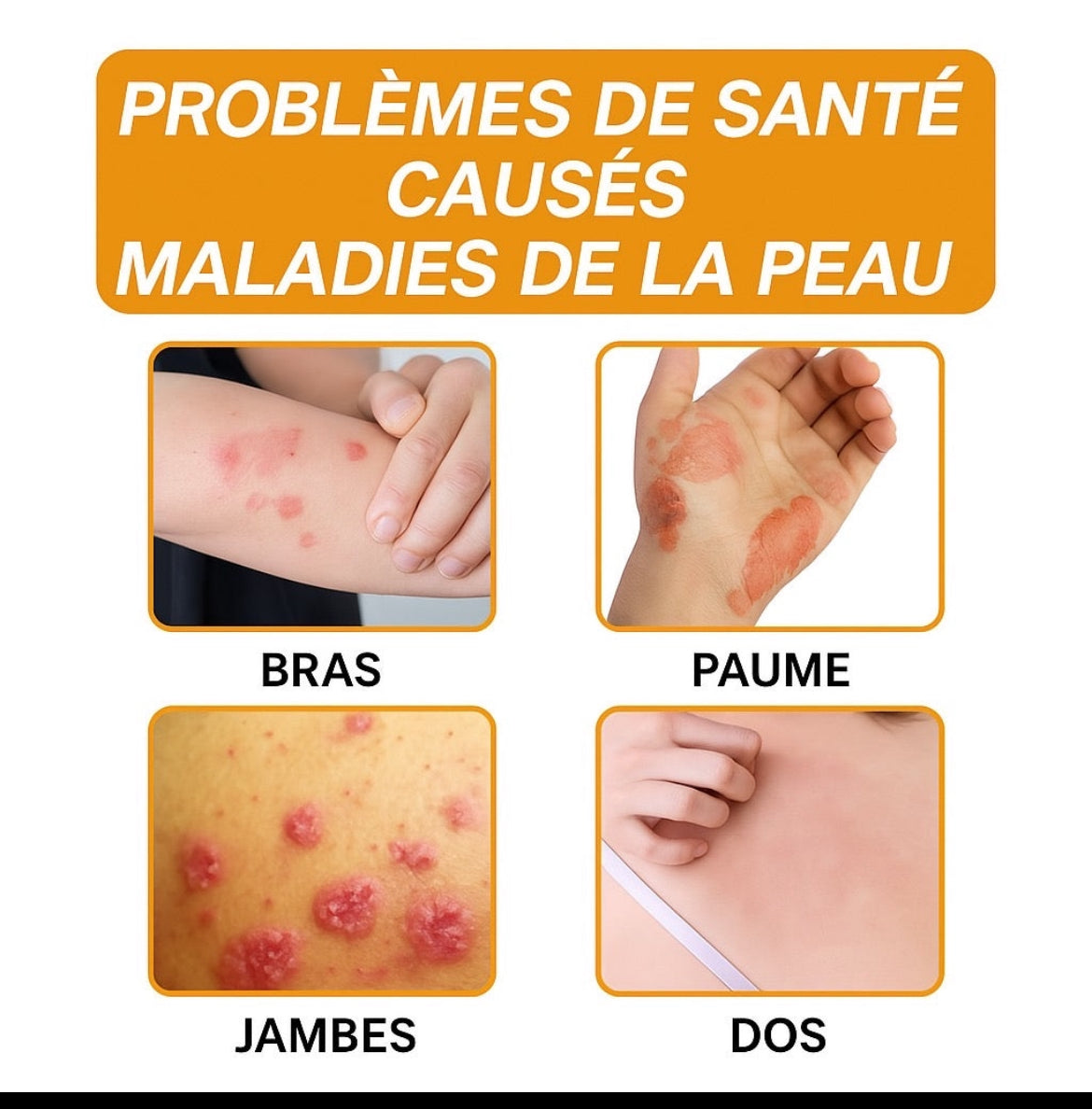 Bee Venom™️ – La crème naturelle pour une peau apaisée.