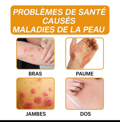 Bee Venom™️ – La crème naturelle pour une peau apaisée.