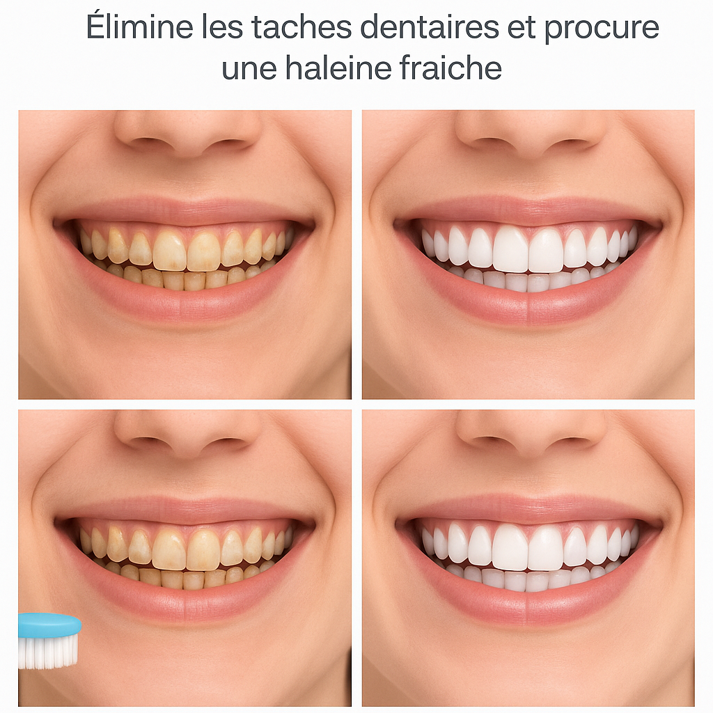 Mousse Ultra-blanchissante WhiteSmile™️
