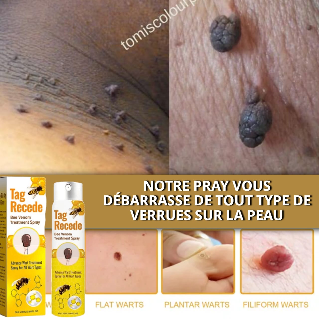 Spray Anti-Verrues Venin d'Abeille