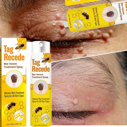 Spray Anti-Verrues Venin d'Abeille